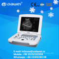 DW-500 diagnostic ultrasound equipment laptop ultrasound scanner